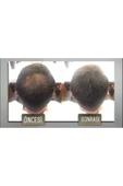 Saç Fiberi Toz Keratin Içeri Siyah 50 gr X 3 Adet - 2
