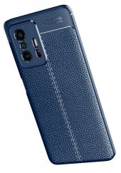 Xiaomi Mi 11T 5G Kılıf Deri Desenli Kamera Korumalı Silikon - 3