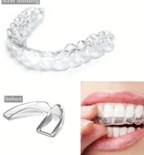 515 Bruksizm Gece Aparatı Plağı - 1