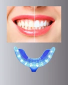 Beyazlatma Kalemli LED Diş Parlatma Seti - 2