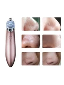 SİYAH NOKTA CİHAZI thumbnail 1