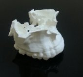 Maxilla Plastik Aparat - 1