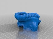 Maxilla Plastik Aparat - 2