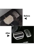 YıldızTuning Peugeot 508 Otomatik Pedal Seti 2011-2018 - 6