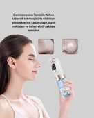 Çok Fonksiyonlu Cilt Bakım Cihazı – Siyah Nokta, Gözenek ve Akne Temizleyici thumbnail 2