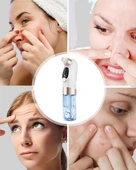 Çok Fonksiyonlu Cilt Bakım Cihazı – Siyah Nokta, Gözenek ve Akne Temizleyici thumbnail 3