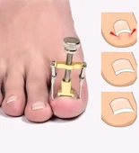 Batık Tırnak Çıkarma Aparatı - 3