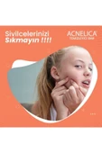 ACNELİCA Temizleyici Bar %2 Siyah Nokta Ve Sivilce Sabunu - 5
