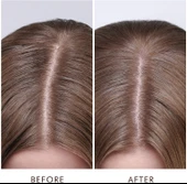 Moroccanoil Dry Scalp Treatment Kuru Saç Derisi Serumu 45ML thumbnail 3