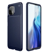 Zore Xiaomi ile uyumlu Mi 11 Lite Kılıf Negro Silikon Kapak - 12