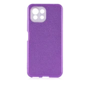 Zore Xiaomi ile uyumlu Mi 11 Lite Kılıf Shining Silikon - 10
