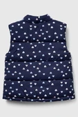 United Colors of Benetton Kız Bebek 2V3YGJ00O-25K Desenli Yelek Lacivert thumbnail 2