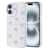 Apple iPhone 16 Pro Kılıf Airbag Tasarımlı Simli Şeffaf  Kutup Kapak thumbnail 2