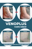 DERMONEM Venoplus Kremi - 4
