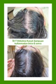 Dökülme Karşıtı Şampuan Hızlı Saç Uzaması Biotin Ve Keratin - 3