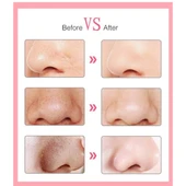 Periboia 6 Başlıklı Vakumlu Siyah Nokta Temizleyici - 3