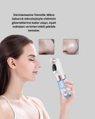 Elektrikli Siyah Nokta Sökücü – Derinlemesine Gözenek Temizleme Cihazı thumbnail 2