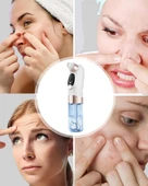 Çok Fonksiyonlu Cilt Bakım Cihazı – Siyah Nokta, Gözenek ve Akne Temizleyici thumbnail 3