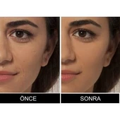 Loreal Paris True Match Kapatıcı 4N Beige thumbnail 4
