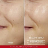 Loreal Paris Revitalift Peeling Etkili Tonik 180 ml thumbnail 3