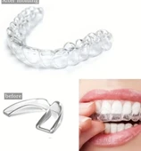 515 Bruksizm Gece Aparatı Plağı thumbnail 1