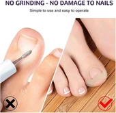 MDB Ayak Tırnağı Düzeltme Bandı 50 Adet thumbnail 3