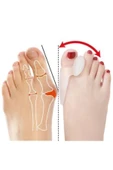 Ayak Bunyon Koruyucu Makaralı 2'li Set Silikon Bunyon Koruyucu thumbnail 2