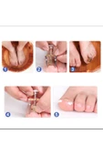 1 Adet Batık Tırnak Düzeltme Aleti Batık Tırnak Çıkartıcı Aparat Ayak Tırnak Batması Pens thumbnail 2