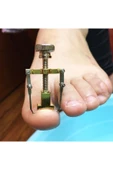 Batık Tırnak Çıkartıcı Ayak Tırnak Batması Düzeltici Pens Aparat thumbnail 4