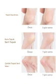 Rahatlatıcı Nemlendirici Silikon Topuk Çorabı Çatlak Ve Topuk Ağrısı Önleyici Ayak Bakım Masaj Çorap - 4
