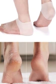 Slikon Topuk Koruması Yarım Çorap Ortopedik Topuk thumbnail 2