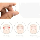 Batık Tırnak Düzeltici Aparat - 2