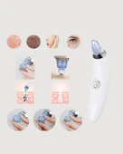 Vakum Teknolojili Siyah Nokta Temizleyici Cihaz – 4 Farklı Başlık ve Derinlemesine Gözenek Temizliği - 4