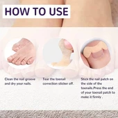 Ayak Tırnağı Düzeltme Bandı 50 Adet - 4