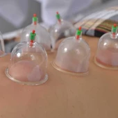 Hacamat Kupa Seti 6 Adet - 3