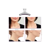 Kırışıklık Giderici Masaj Cihazı thumbnail 3