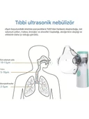 Taşınabilir Mesh Nebulizatör Şarjlı 3 Kademeli Sessiz Aeroterapi Cihazı – Çocuk & Yetişkin Uyumlu - 4