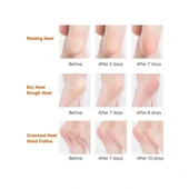 Silikon Topuk Nemlendirici Çorap - 4