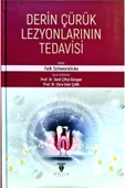 Celsus Kitabevi Derin Çürük Lezyonlarının Tedavisi - 1