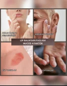 Elvons Lip Balm - Dudak Kremi - Vazelin, Kakao & Shea Yağı - Onarıcı & Nemlendirici Krem 25ml - 3