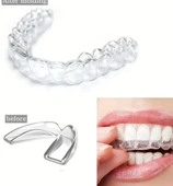 515 Bruksizm Gece Aparatı Plağı thumbnail 1