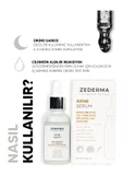 Akne Serum - 4