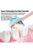 NPO Nicefeel X610-Z Dakikada 40000 Titreşim, Şarjlı Sonic Profesyonel Diş Fırçası-Pembe thumbnail 5