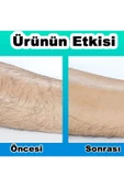 ONULISS Kristal Epilatör Crystal Eraser Epilasyon Tüy Dökücü Sertifikalı thumbnail 2