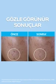 La Roche Posay Effaclar Yağlı ve Akneye Eğilimli Citler için Temizleme Jeli 400 ml thumbnail 2