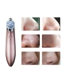 LitaeTrend SİYAH NOKTA CİHAZI thumbnail 1