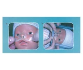 EPAROX HİDROKOLLOİD BURUN BANDI NO:0 thumbnail 1