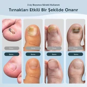 ShoptTech 36W Katlanabilir Tırnak Mantarı Işık Cihazı El ve Ayak Tırnağı İçin LED Fototerapi Lambası, USB Şarjlı thumbnail 8