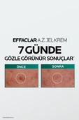 La Roche Posay Effaclar A.Z. %10 Azelaik Asit İçeren Sivilce & Sivilce İzi & Kırışıklık Karşıtı Jel Krem 40ml thumbnail 4
