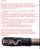 Philips İle Uyumlu XC7040, XC7043 SpeedPro Max, XC8349 Aqua Plus Kablosuz Şarjlı Dikey Süpürge Boru Tamir Seti thumbnail 4